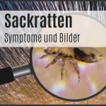 Was haben Filzläuse mit Pornos zu tun?