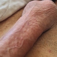 M20offen